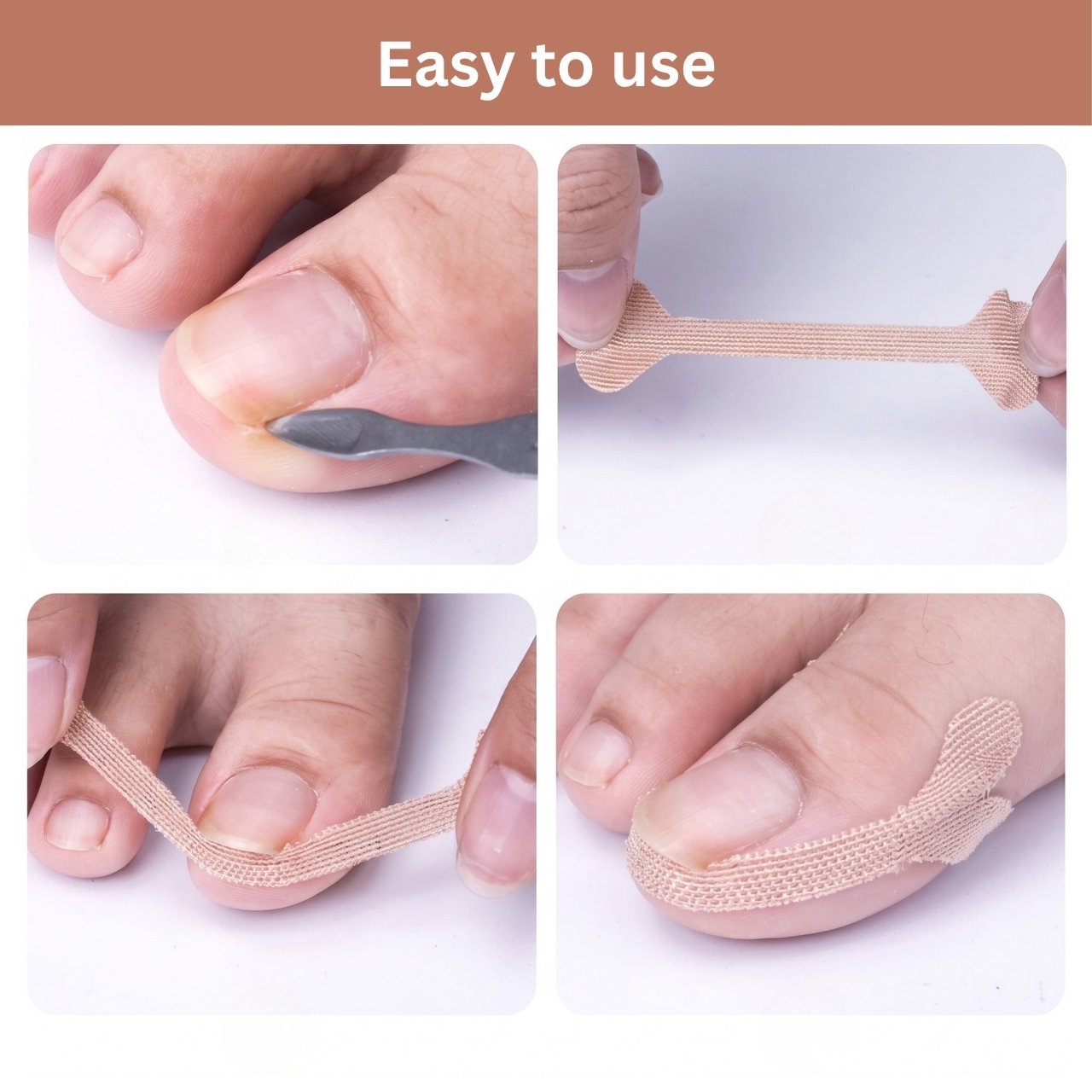 Пластири за корекция на врастнали нокти, ProPatches - Image 9