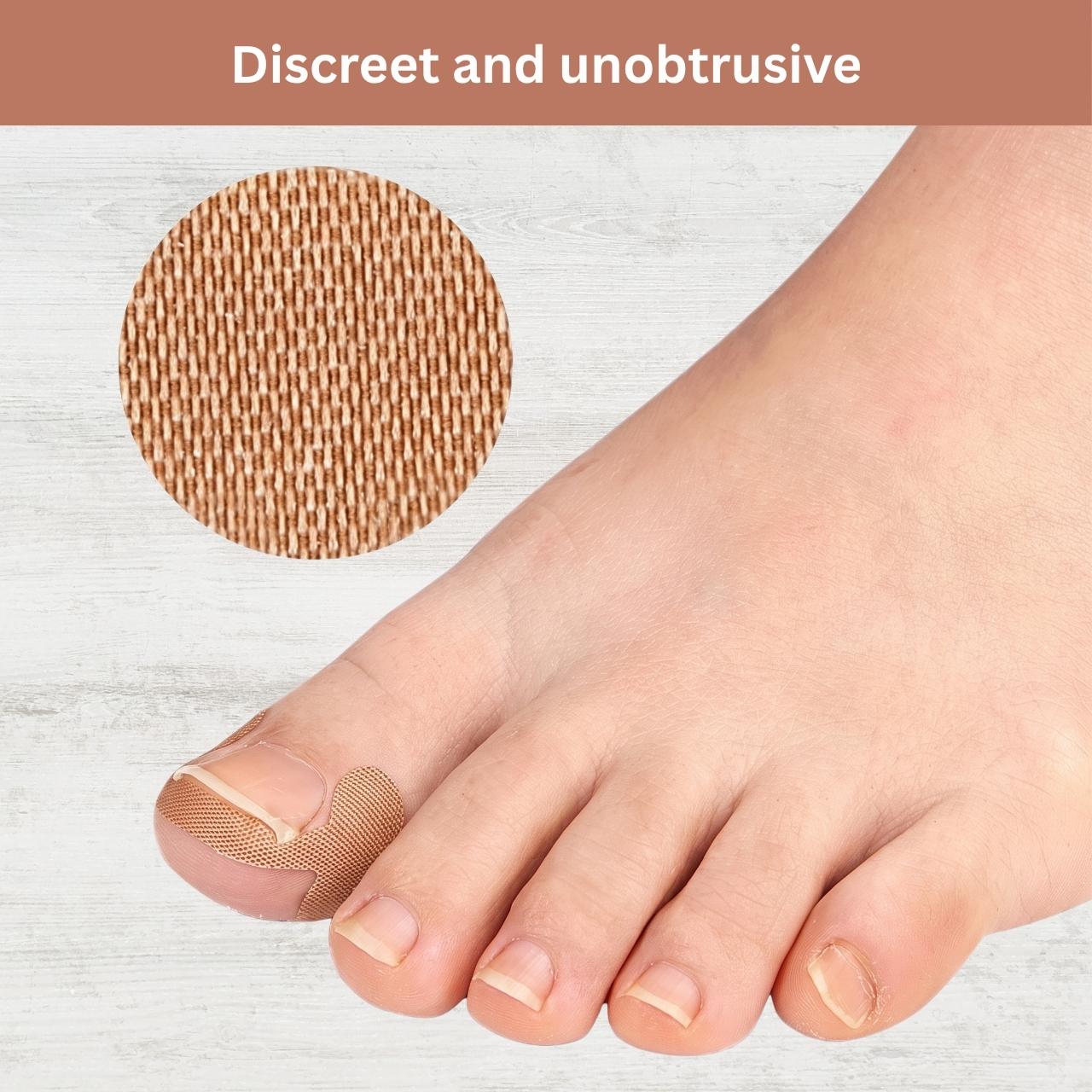 Пластири за корекция на врастнали нокти, ProPatches - Image 10
