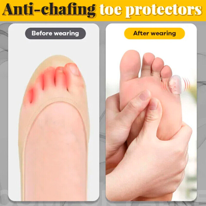 ToeProtector, силиконов протектор за пръсти на краката (10 броя) - Image 5